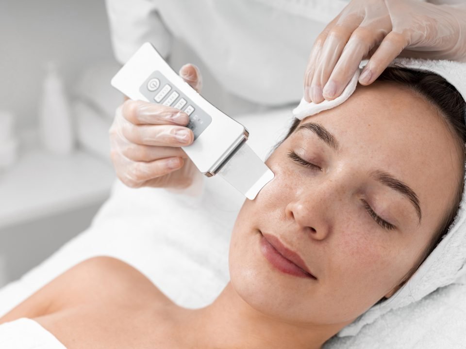 peeling ultrsonico en Estética Adela Moro